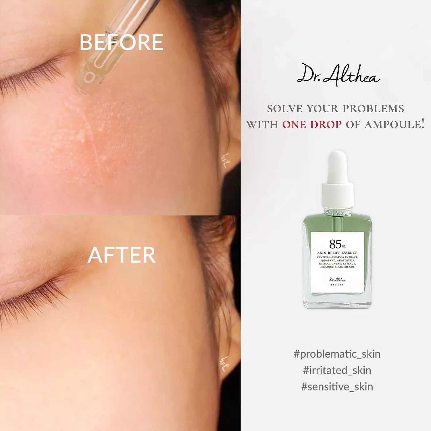 Dr. Althea - Skin Relief Essence 30ml 1